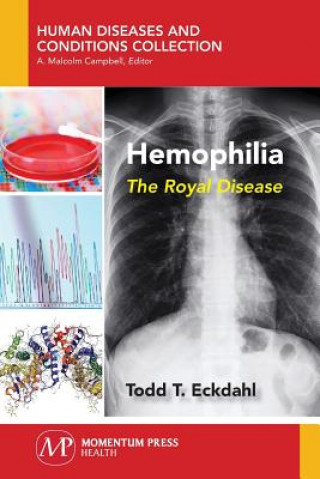 Książka HEMOPHILIA Todd Eckdahl