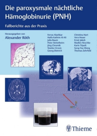 Kniha Die paroxysmale nächtliche Hämoglobinurie (PNH) Alexander Röth