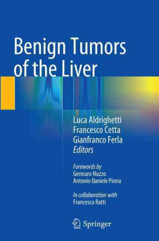 Kniha Benign Tumors of the Liver Luca Aldrighetti