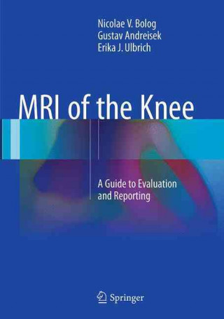 Kniha MRI of the Knee Nicolae V. Bolog