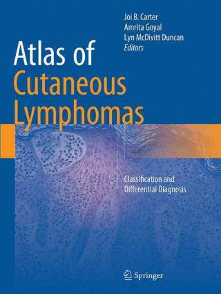 Βιβλίο Atlas of Cutaneous Lymphomas Joi B. Carter