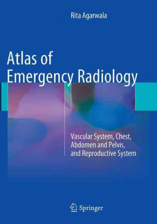 Książka Atlas of Emergency Radiology Rita Agarwala