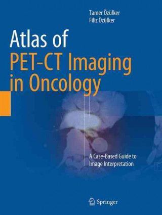 Książka Atlas of PET-CT Imaging in Oncology Tamer Ozulker