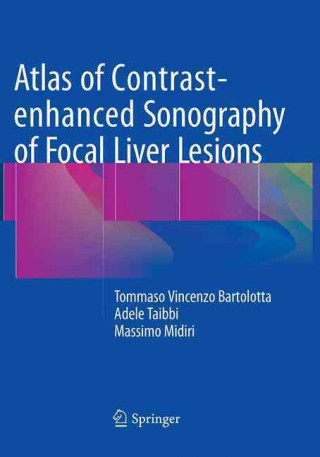 Kniha Atlas of Contrast-enhanced Sonography of Focal Liver Lesions Tommaso Vincenzo Bartolotta