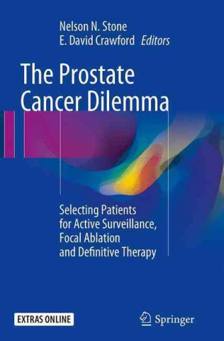 Knjiga Prostate Cancer Dilemma Nelson N. Stone