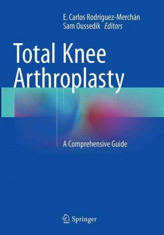 Книга Total Knee Arthroplasty E. Carlos Rodriguez-Merchan