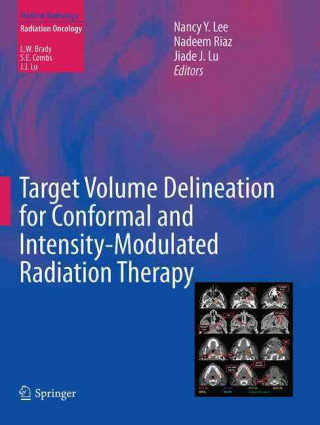 Könyv Target Volume Delineation for Conformal and Intensity-Modulated Radiation Therapy Nancy Y. Lee