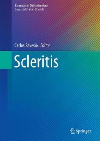 Книга Scleritis Carlos Pavesio