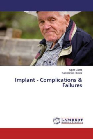 Livre Implant - Complications & Failures Arpita Gupta