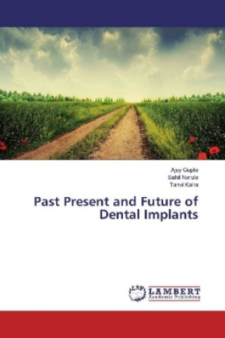 Książka Past Present and Future of Dental Implants Ajay Gupta