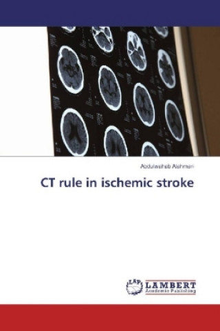 Książka CT rule in ischemic stroke Abdulwahab Alahmari