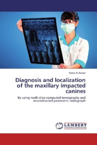 Książka Diagnosis and localization of the maxillary impacted canines Nadia Al-Ansari