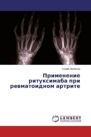 Carte Primenenie rituximaba pri revmatoidnom artrite Sofiya Avlohova