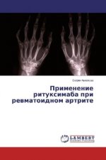 Könyv Primenenie rituximaba pri revmatoidnom artrite Sofiya Avlohova