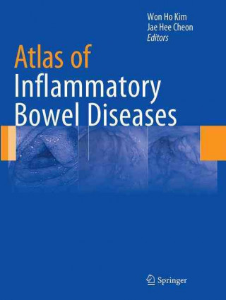 Kniha Atlas of Inflammatory Bowel Diseases Won Ho Kim