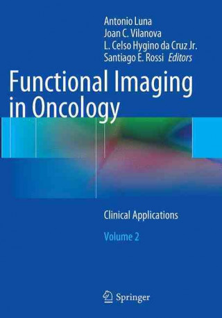 Książka Functional Imaging in Oncology Antonio Luna