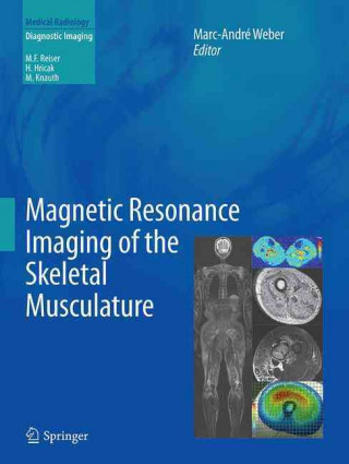 Książka Magnetic Resonance Imaging of the Skeletal Musculature Marc-André Weber