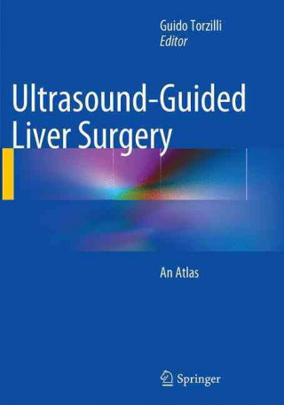 Kniha Ultrasound-Guided Liver Surgery Guido Torzilli