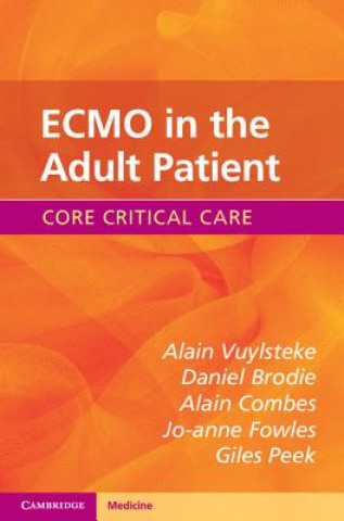 Könyv ECMO in the Adult Patient Alain Vuylsteke
