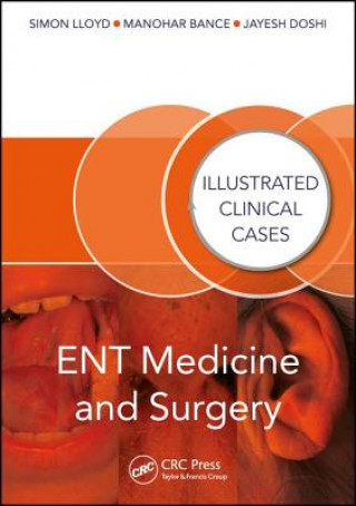 Kniha ENT Medicine and Surgery Manohar Bance