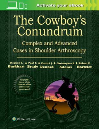 Könyv Cowboy's Conundrum: Complex and Advanced Cases in Shoulder Arthroscopy Stephen S Burkhart