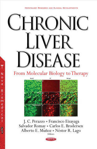 Carte Chronic Liver Disease 