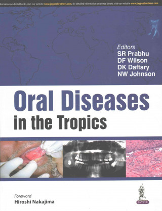 Kniha Oral Diseases in the Tropics S R Prabhu