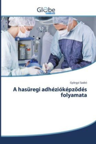 Könyv A hasüregi adhézióképzodés folyamata Györgyi Szabó