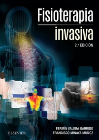 Könyv Fisioterapia invasiva + acceso web FERMIN VALERA