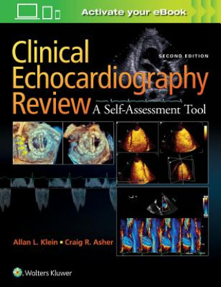 Kniha Clinical Echocardiography Review Allan L. Klein