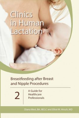Carte Clinics in Human Lactation: v. 2 - Breastfeeding After Breast and Nipple Procedures Diana West