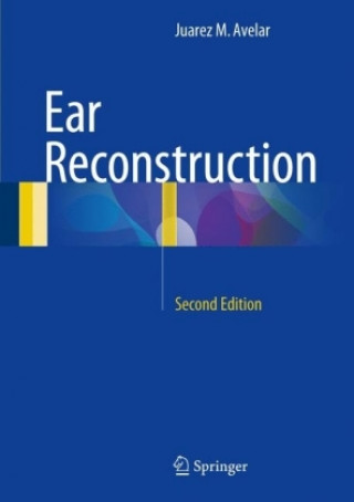 Carte Ear Reconstruction Juarez M. Avelar