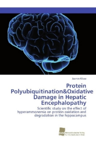 Könyv Protein Polyubiquitination&Oxidative Damage in Hepatic Encephalopathy Jasmin Klose