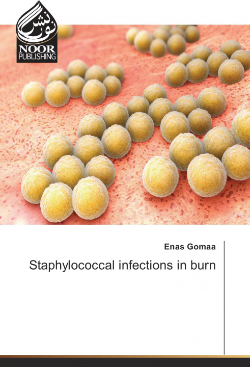 Carte Staphylococcal infections in burn Enas Gomaa