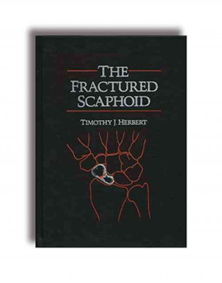 Książka Fractured Scaphoid Timothy J. Herbert