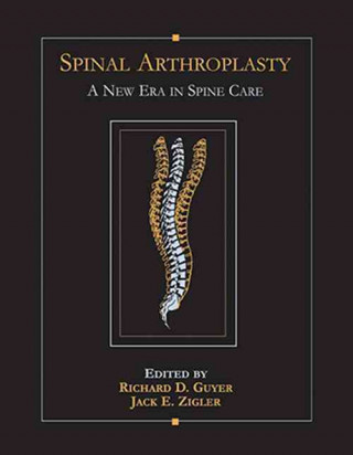 Kniha Spinal Arthroplasty Richard Guyer