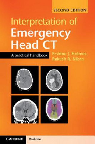 Book Interpretation of Emergency Head CT Erskine J. Holmes
