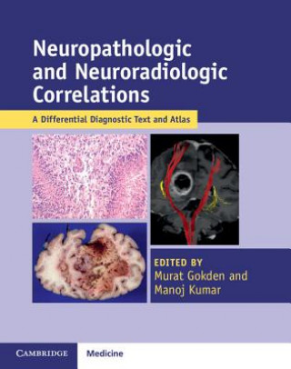 Kniha Neuropathologic and Neuroradiologic Correlations Murat Gokden