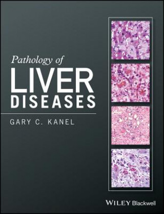 Kniha Pathology of Liver Diseases GARY C. KANEL