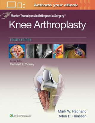 Könyv Master Techniques in Orthopedic Surgery: Knee Arthroplasty Mark W. Pagnano