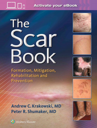 Kniha Scar Book Andrew C. Krakowski