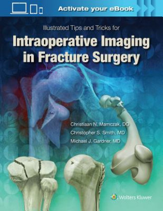 Kniha Illustrated Tips and Tricks for Intraoperative Imaging in Fracture Surgery Michael J. Gardner