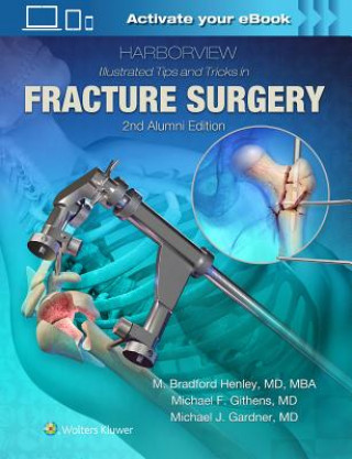 Книга Harborview Illustrated Tips and Tricks in Fracture Surgery M. Henley