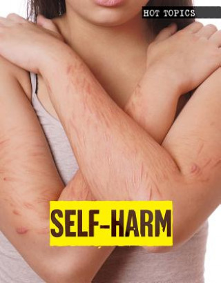 Book Self-Harm Toney Allman