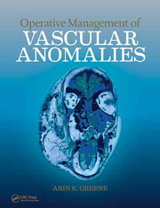 Könyv Operative Management of Vascular Anomalies Greene