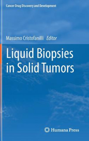 Kniha Liquid Biopsies in Solid Tumors Massimo Cristofanilli