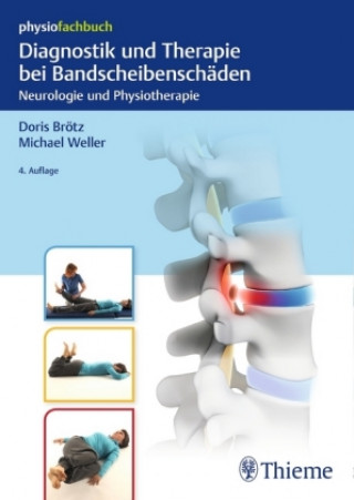 Libro Diagnostik und Therapie bei Bandscheibenschäden Doris Brötz