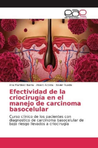 Könyv Efectividad de la criocirugía en el manejo de carcinoma basocelular Ana Martínez Ibarra