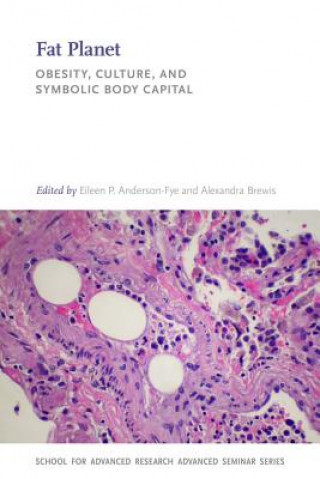 Книга Fat Planet: Obesity, Culture, and Symbolic Body Capital Eileen P. Anderson-Fye