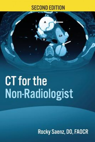 Kniha CT for the Non-Radiologist Rocky Saenz